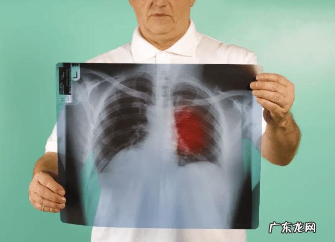 肺部变白是什么病引起的?肺脏变白可能是这几种原因,早知道早好