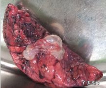 肺里有泡这个情况严重吗？如何判断是否出现肺部水泡