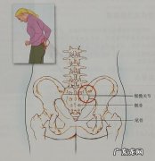 骶椎骨压迫神经的症状有哪些？如何判断自己是否患有骶椎骨压迫神经症？