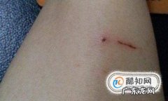 被野猫抓伤出血怎么办如何处理