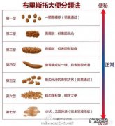 狗狗拉不出屎怎么办? 狗狗拉不出屎怎么办