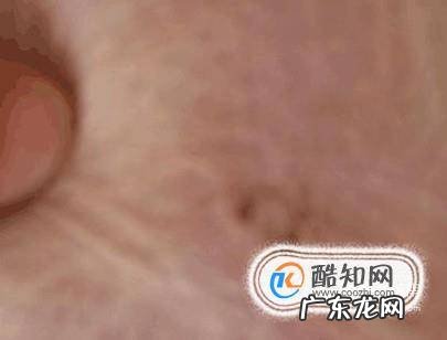 金毛狗狗的皮肤病要如何处理