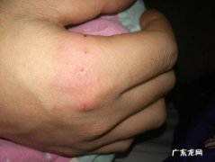 孩子被猫咬了一个多月才知道,家长心都碎了：我们错了？