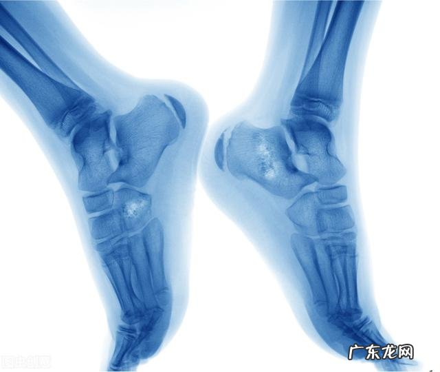 骨癌的前兆是什么症状怎么检查 骨癌的前兆是什么症状