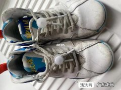 怎么清洗小白鞋最干净？小白鞋清洗技巧