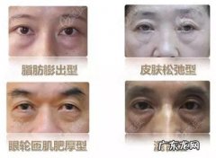 去眼袋一般多少钱 现在割眼袋一般价格多少