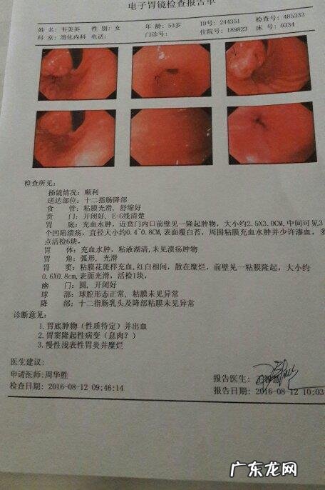胃癌最简单的检查方法 判断胃癌最简单的方法是什么