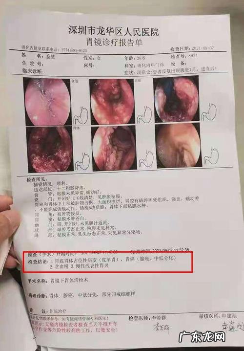 得了胃癌一般能活多久 胃癌晚期还能活多久一般