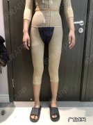 水动力抽脂能瘦到什么程度 抽脂能瘦到什么程度