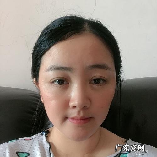 还能不能恢复啊 外切眼袋眼下凹陷能恢复吗