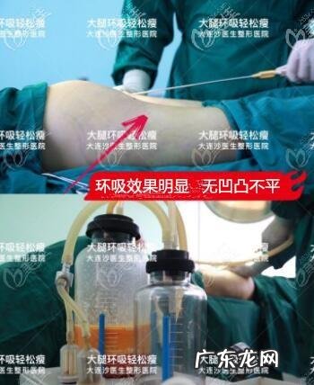 背部抽脂需要多少钱 在正规医院抽脂需要多少钱