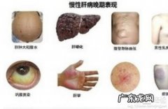 都有哪些症状呢 肝病会出现哪些症状