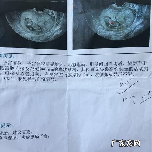 子宫不全纵隔怀孕几率是是多少