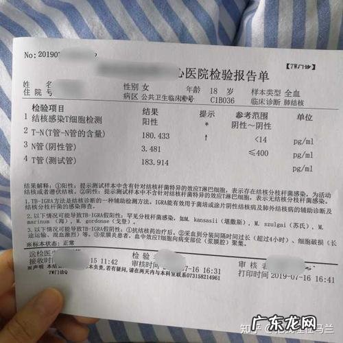 肺结核怎样检测出来
