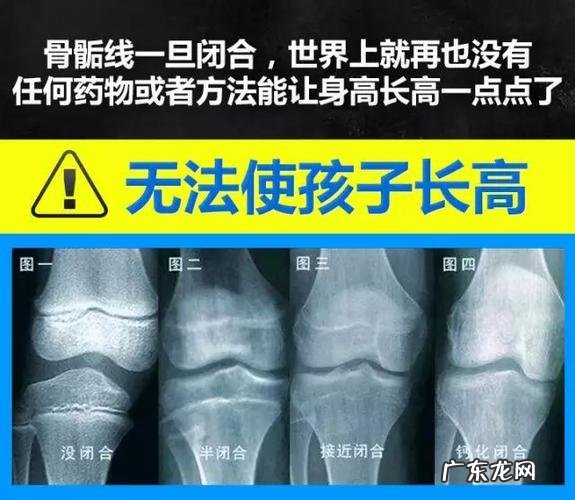 什么是骺软骨