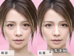 去除眼袋的方法有哪些 消除眼袋的方法有哪些