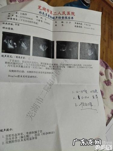 先天性子宫纵隔是什么意思