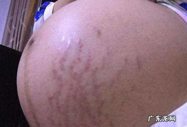 怀孕没黑线的基本是女宝宝真的吗