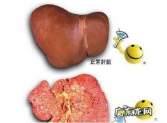 肝炎要多久才能恢复