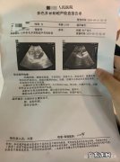 黄体破裂是阵痛还是持续痛