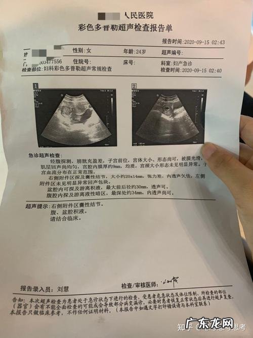 黄体破裂是阵痛还是持续痛