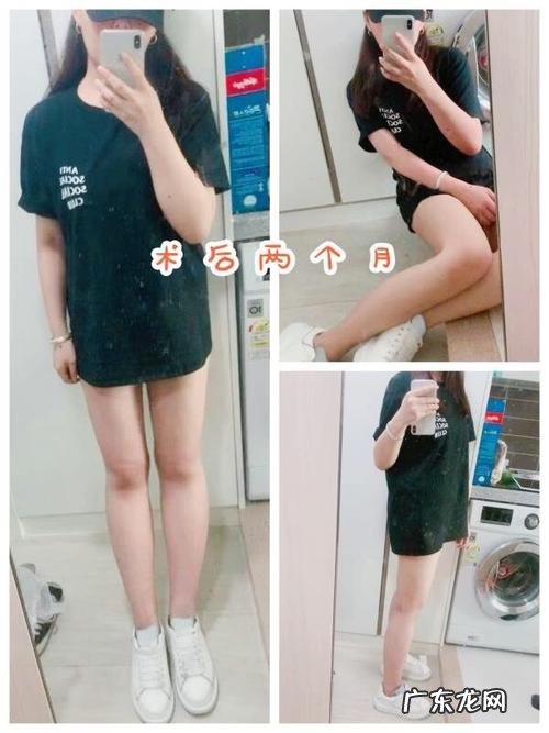 吸脂可乐真的吸脂吗