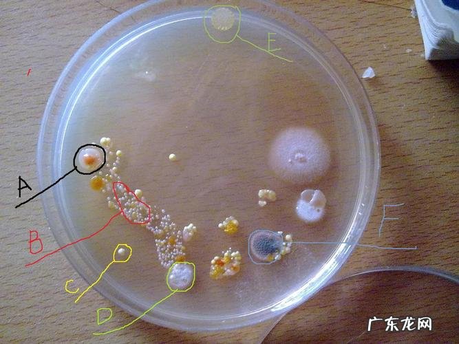 如何全自动计数培养皿上的微生物、菌落