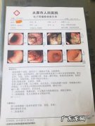 胃癌晚期能撑过6次化疗吗