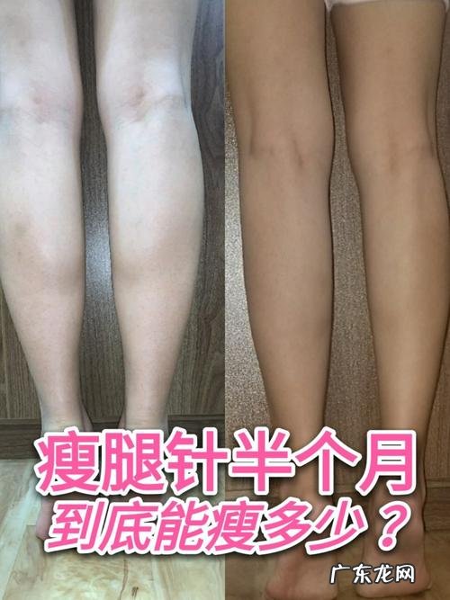 打瘦腿针多久有效果 瘦腿针几天开始有效果