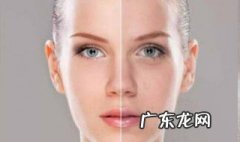 晒伤后怎样美白 晒伤后怎样美白皮肤