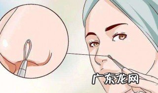 怎么清理黑头收缩毛孔 怎么清理黑头缩小毛孔