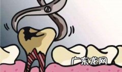 梦见拔牙 梦见拔牙出血什么预兆