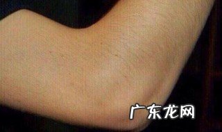 胳膊肘黑怎么变白 胳膊肘黑怎么变白最有效