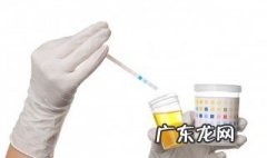人尿含什么成份最多 人尿含什么成份