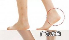 鞋子磨脚怎么处理 真皮鞋子磨脚怎么处理
