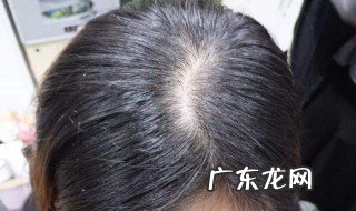 头发油能天天洗吗 头发油可以天天洗头吗