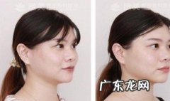 男生如何减双下巴 如何减双下巴