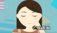 如何消除黄褐斑黄褐斑 如何消除黄褐斑