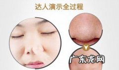 怎样去黑头收缩毛孔粗大 怎样去黑头收缩毛孔