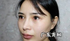 如何去除眼袋最快方法 如何去除眼袋