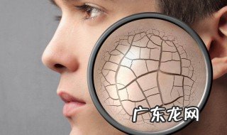 脸上皮肤干燥 脸上皮肤干燥起皮屑怎么办才能有效啊