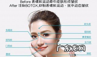 怎样去除鱼尾纹和眼部细纹 怎样去除鱼尾纹