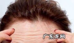 去除抬头纹有效的方法 去除抬头纹有效的方法是什么