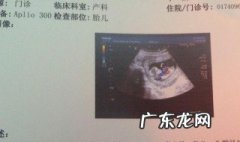 怎么知道怀孕没有 怎么知道怀孕