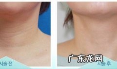 脖子上皱纹怎么去除 怎么去脖子皱纹