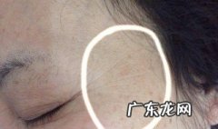 怎么去除脸部皱纹 怎么去除脸部皱纹小妙招