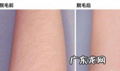 手臂脱毛怎么脱 手臂脱毛的方法