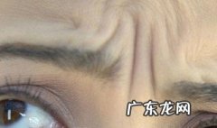 额头纹怎么消除 额头纹怎么消除效果最好