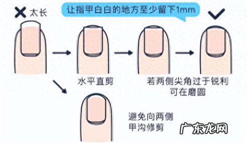 脚趾甲老往肉里钻,一碰还疼?教你小妙招,预防甲沟炎告别疼痛