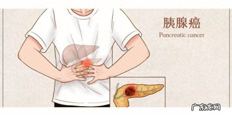 胰腺癌:从确诊到死亡仅仅3个月!四个症状,可能是胰腺在求救